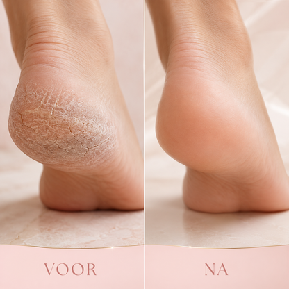 SoftStep™ Voetverzorger