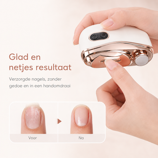 EasyNail™ Nagelverzorger — Laat het apparaat het werk doen.