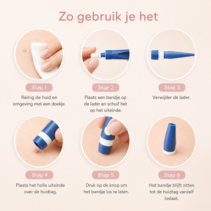 TagAway™ Huidtag Verwijderingsset — Klein voor een ander. Storend voor jou.