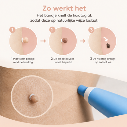 TagAway™ Huidtag Verwijderingsset — Klein voor een ander. Storend voor jou.