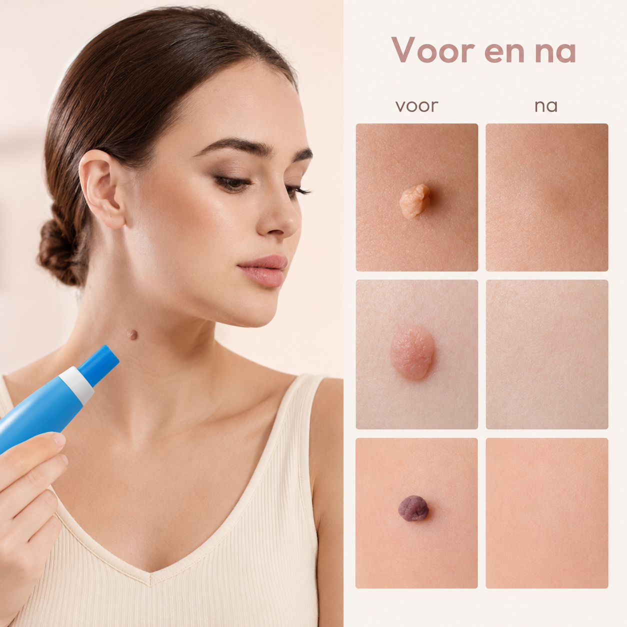 TagAway™ Huidtag Verwijderingsset — Klein voor een ander. Storend voor jou.