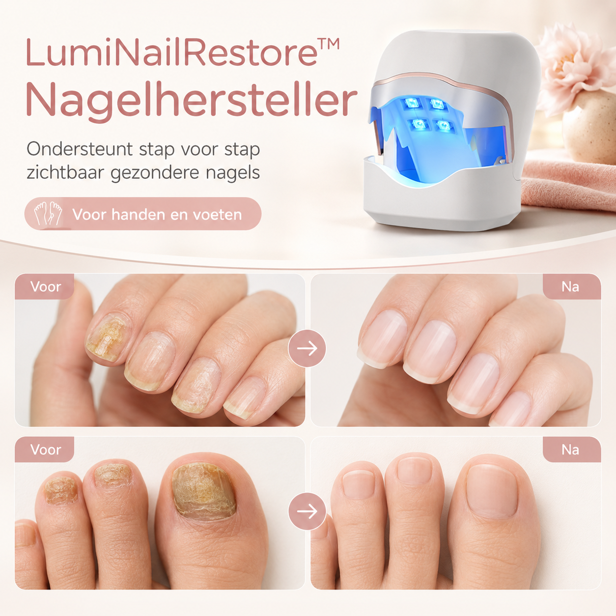 LumiNailRestore™ Nagelhersteller – Gezonde nagels zonder schaamte.