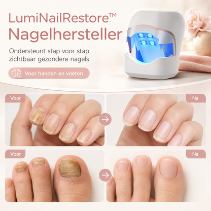 LumiNailRestore™ Nagelhersteller – Gezonde nagels zonder schaamte.