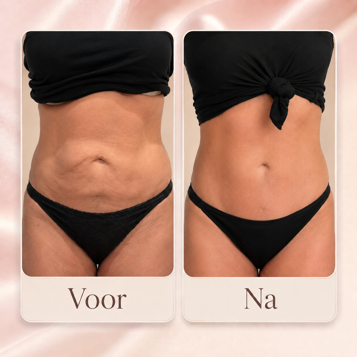BodySculpt™ Cupping Massager