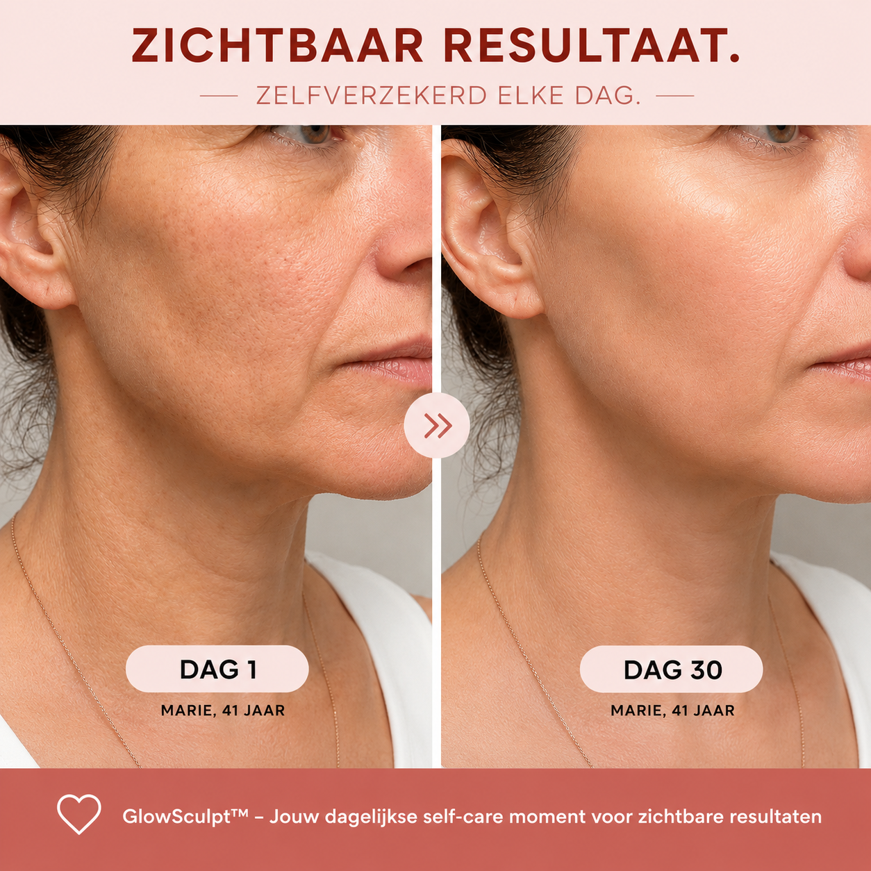 GlowSculpt™ LED Face & Neck Lifter